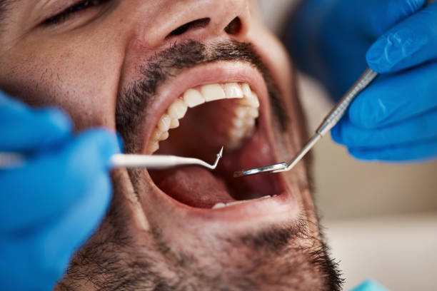 Emergency Dental Services in Cassville, MO