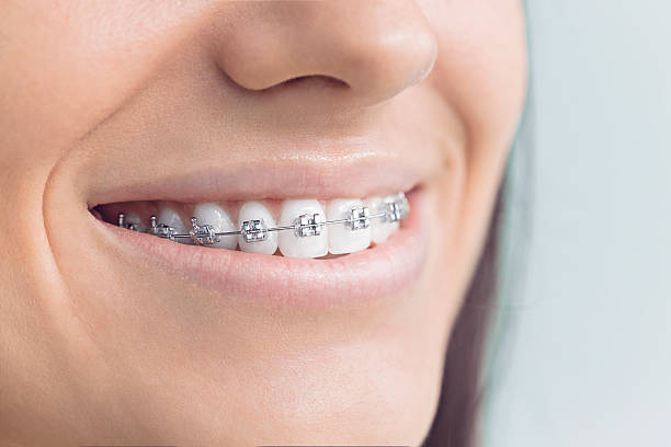 Trusted Cassville, MO Holistic Dental Care Services Experts